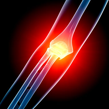 Ulnar Nerve Transposition