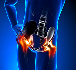 Total Hip Replacement Revision Surgery Total Hip Replacement Revision Surgery