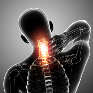 Cervical Spinal Stenosis