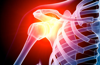 Total Shoulder Replacement Total Shoulder Replacement