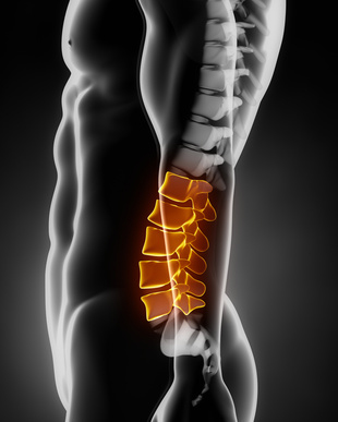Lumbarization of the Spine