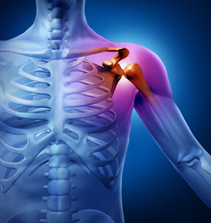 Myofascial Pain Due to Trigger Points